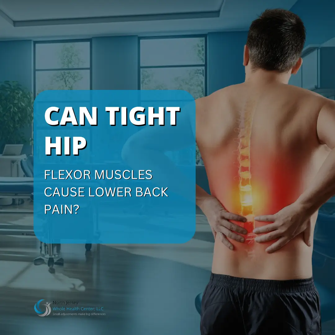 QA: Can tight hip flexor muscles cause lower back pain?